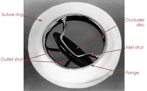 File:Disc Valves1.jpg